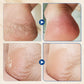 🔥While Supplies Last 40% OFF!🎉 Hydrating and Anti-Cracking Foot Cream