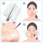 💓HOT SALE 57% OFF💥Stainless Steel Blackhead Removal Kit (with free alcohol pads)
