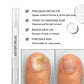 🔥While Supplies Last 40% OFF!🎉 Toenail Fungus Treatment Pen for Damaged Nails