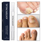 🔥While Supplies Last 40% OFF!🎉 Toenail Fungus Treatment Pen for Damaged Nails