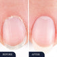 🔥While Supplies Last 40% OFF!🎉 Toenail Fungus Treatment Pen for Damaged Nails